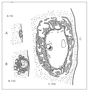 図4.1 第7日から15日の胚盤胞の発達（1968年版の Blechschmidt から）